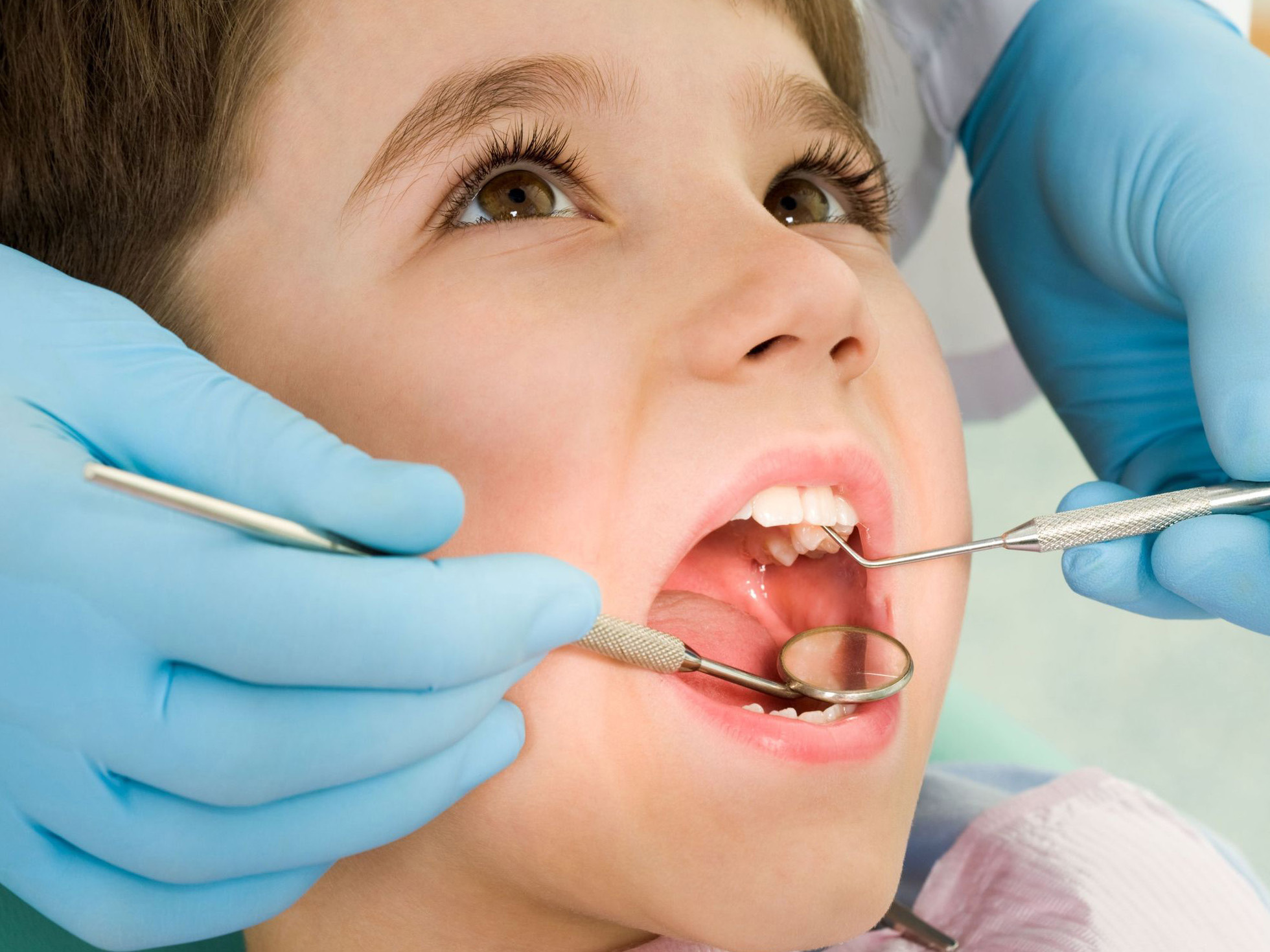 Phòng tránh sâu răng ở trẻ